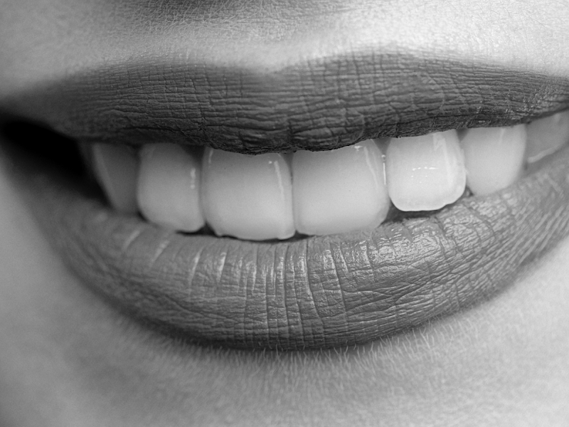 Foto de Up Care Odonto Digital - Invisalign Doctor