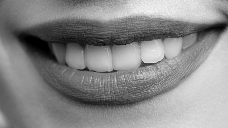 Foto 2 de Up Care Odonto Digital - Invisalign Doctor