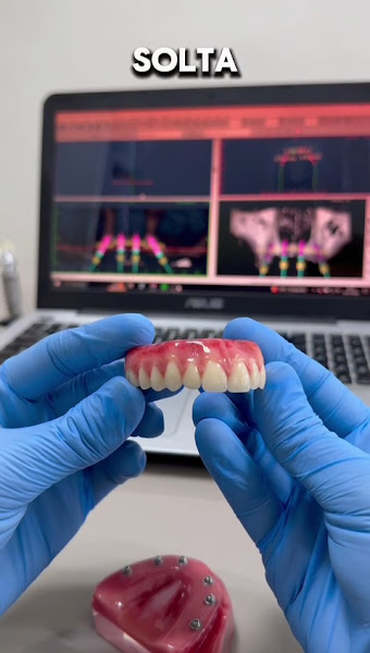 Foto 4 de UpDente clinica odontológica | Dentista - Implantes, Harmonização, Clareamento, Ortodontia, Extrações.