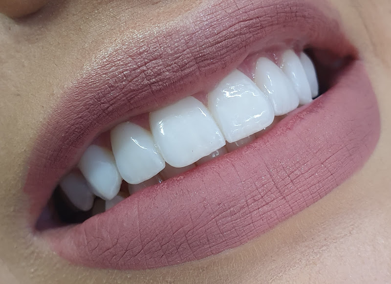 Foto 3 de Urgência odontologica