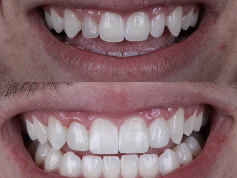 Foto 7 de US Dental Clínica Odontológica