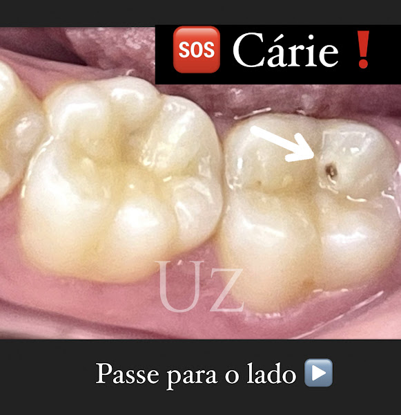 Foto 3 de Uzun Odontologia