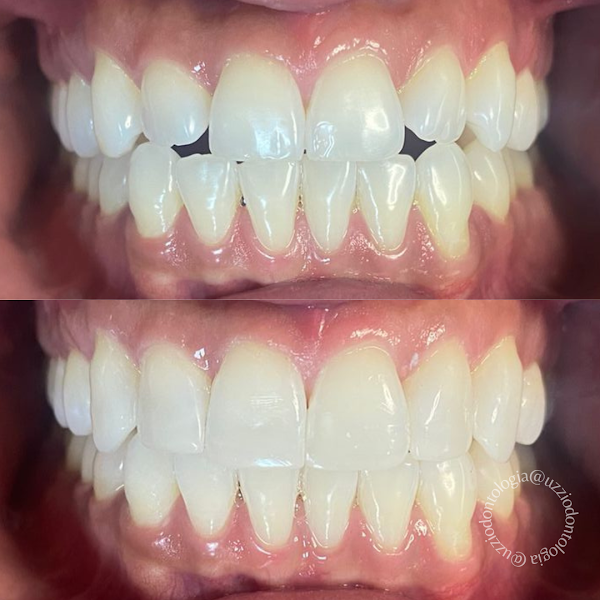 Foto 3 de Uzzi Odontologia