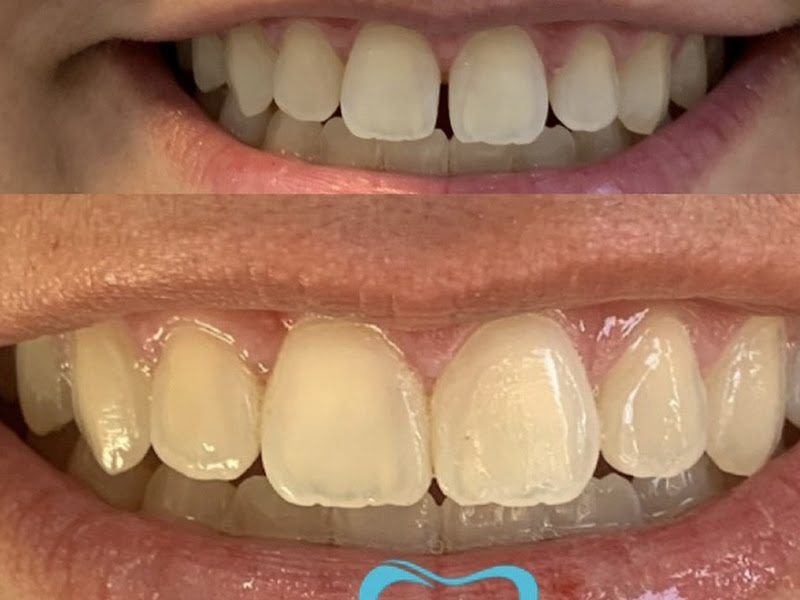 Foto 8 de Vaccaro Odontologia | Implante Dentário | Invisalign | Centro | Guarulhos - SP