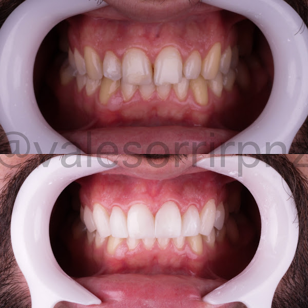 Foto 3 de Vale Sorrir - Clínica odontológica