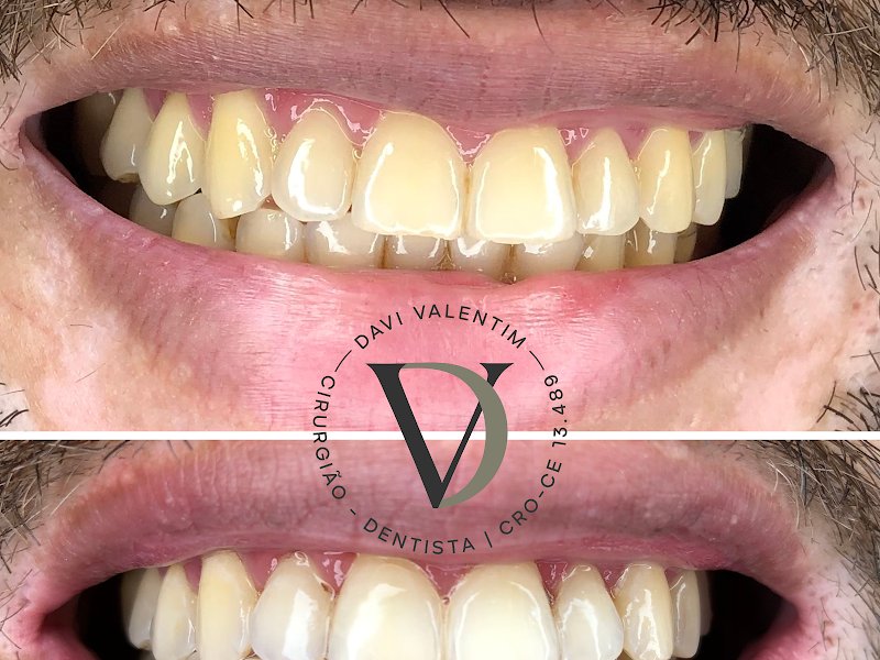 Foto 2 de Valintim Odontologia | Consultório Odontológico