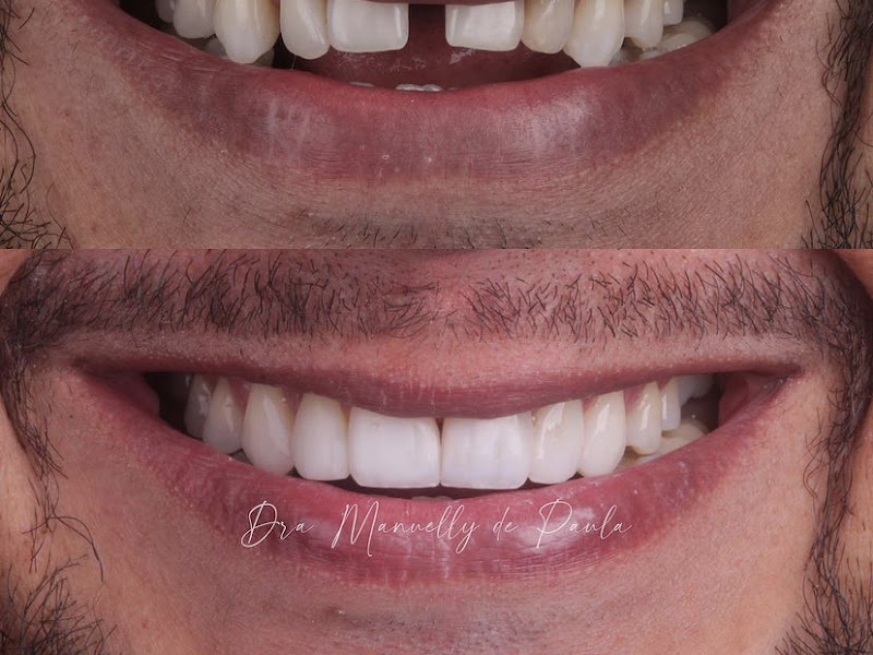 Foto 6 de Vallace Odontologia