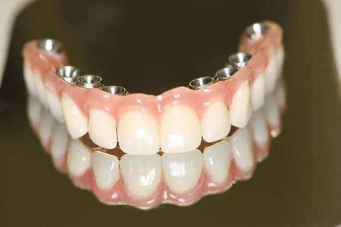 Foto 2 de Vallim Oral Prime Consultórios Odontológicos