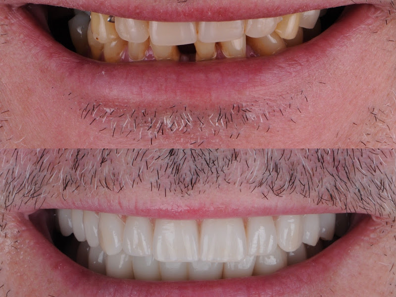 Foto 3 de Valter Battilani Filho Odontologia