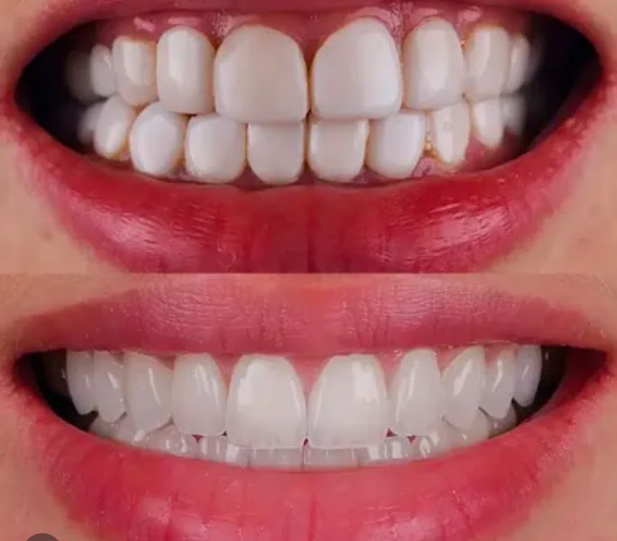 Foto 2 de VAN CLIN ODONTOLOGIA Especializada