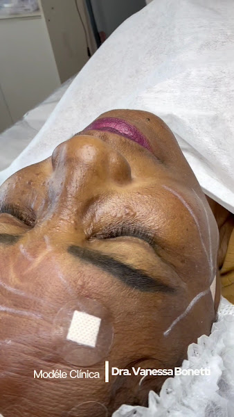 Foto 3 de Vanessa Bonetti | Clínica Modèle Itaboraí | estética integrativa pós operatório e Mentorias em saúde estética.