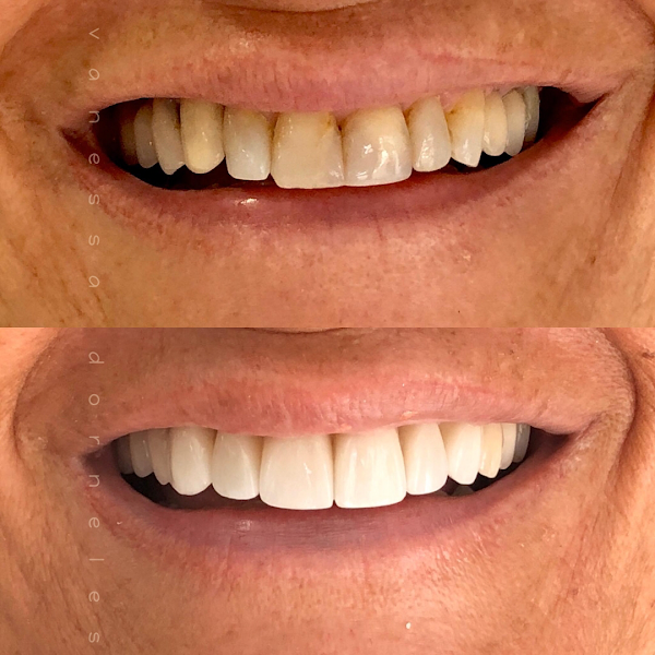 Foto 3 de Vanessa Dorneles - Odontologia Boutique