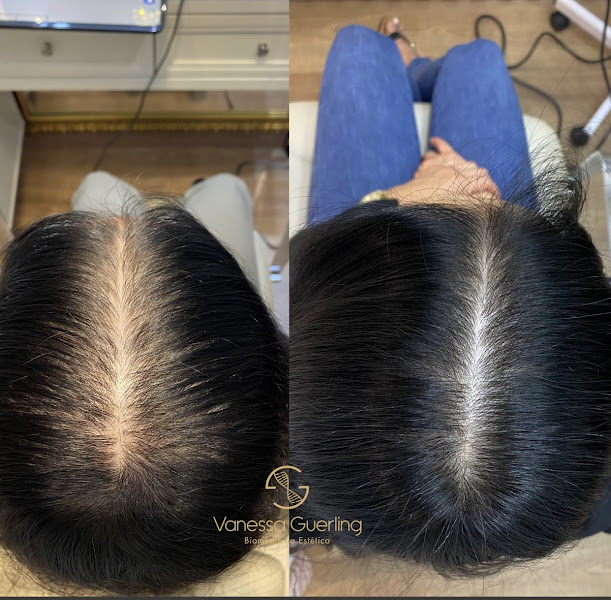 Foto 3 de Vanessa Guerling Biomédica Tricologista