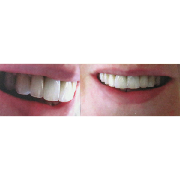 Foto 3 de Vania Biglia - Dentista