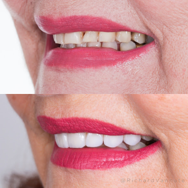 Foto 2 de Vannutes Clínica Odontológica