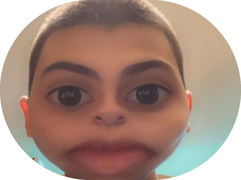 Foto 5 de VDutra Odontologia Dentista - Franca/SP