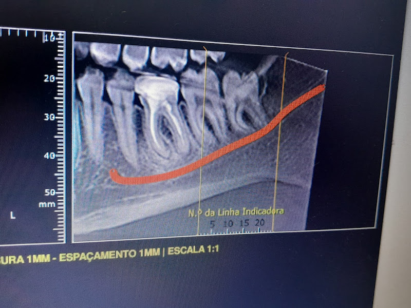 Foto 7 de VDutra Odontologia Dentista - Franca/SP
