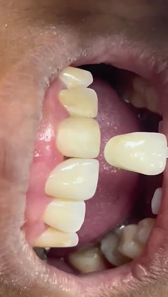 Foto 3 de Vellasco Odontologia