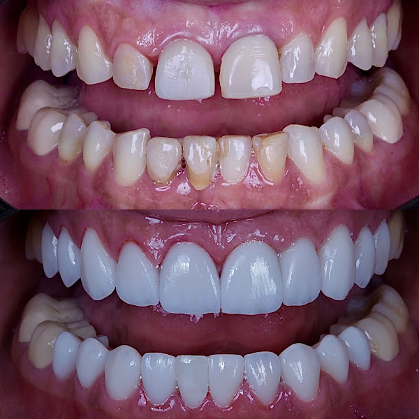 Foto 2 de Velloso Odontologia - Facetas em Vitória