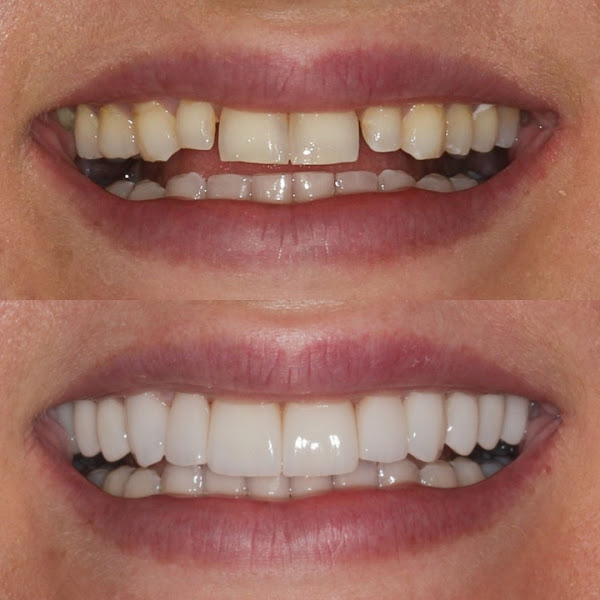 Foto 2 de Vem Sorrir Chapecó Belaver Odontologia