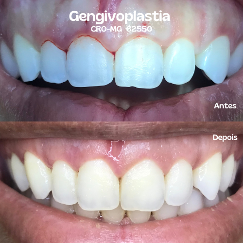 Foto de Vem Sorrir Clínica do Povo | Dentista em Santa Rita do Sapucaí l Implantes e Próteses Dentárias l Ortodontia l Limpeza