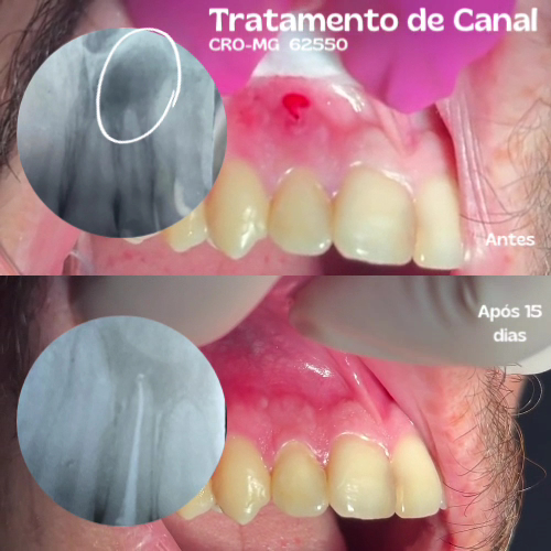 Foto 3 de Vem Sorrir Clínica do Povo | Dentista em Santa Rita do Sapucaí l Implantes e Próteses Dentárias l Ortodontia l Limpeza