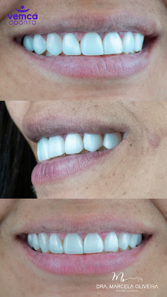 Foto 2 de VemCá Odonto