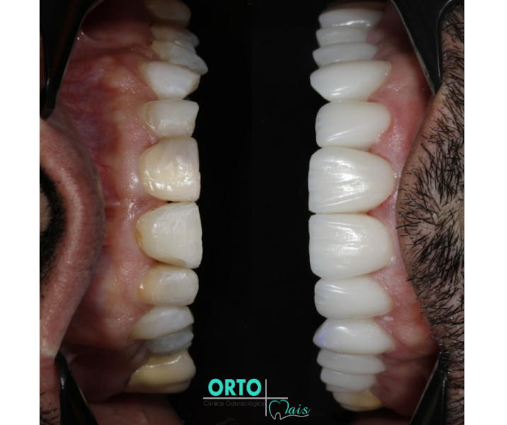 Foto 3 de Venere Odontologia