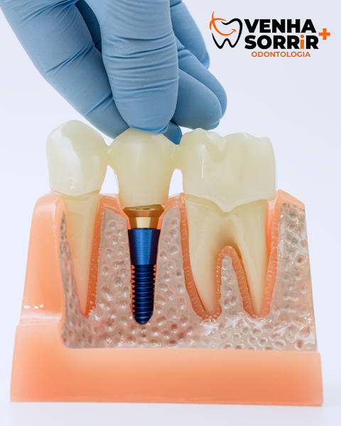 Foto 2 de Venha Sorrir + Odontologia