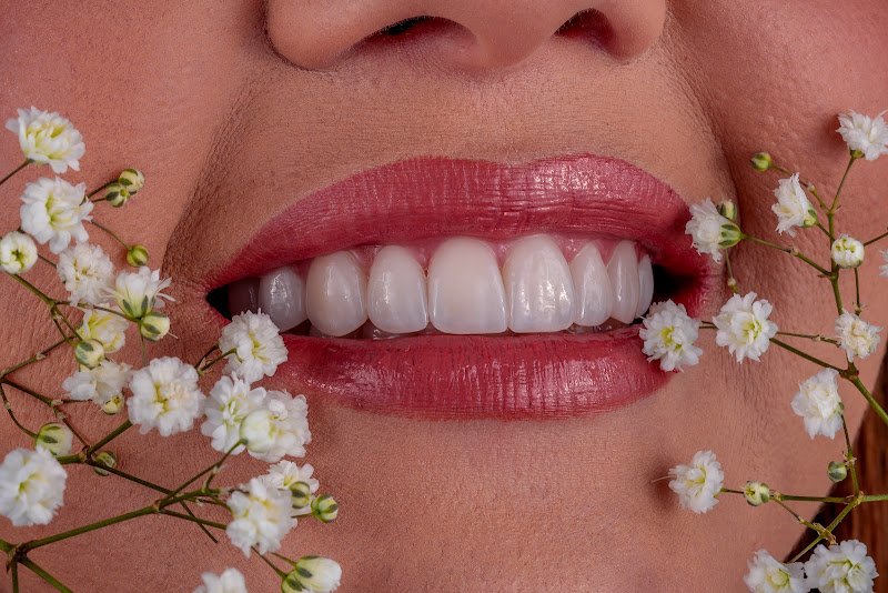 Foto 2 de Venko Odontologia