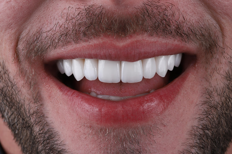 Foto 3 de Venko Odontologia