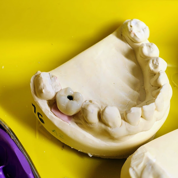 Foto 2 de Verônica Silva · Laboratório de Prótese Dentária
