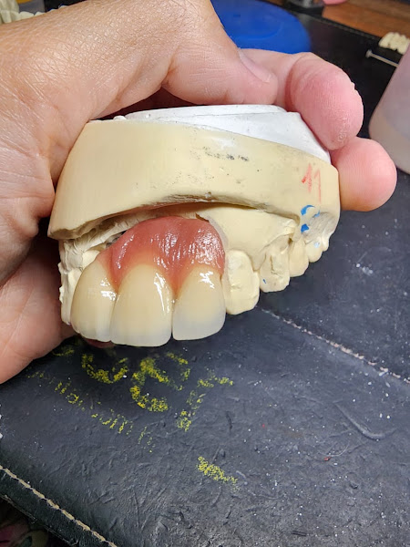 Foto 3 de Verônica Silva · Laboratório de Prótese Dentária