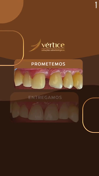 Foto 3 de Vértice Soluções Odontológicas