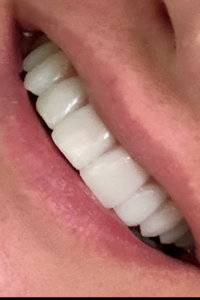 Foto 3 de Verus Odontologia | A Melhor Clínica Odontológica em Santana/SP | Seu Melhor Sorriso é Nossa Prioridade há 14 Anos