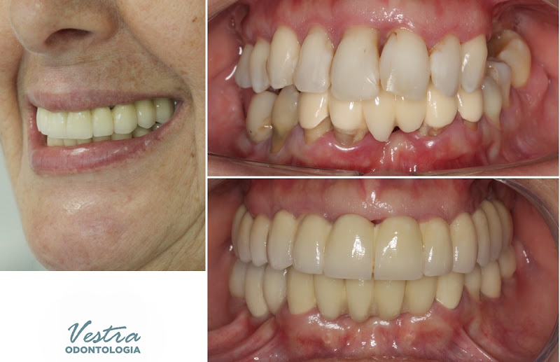 Foto 3 de Vestra Odontologia
