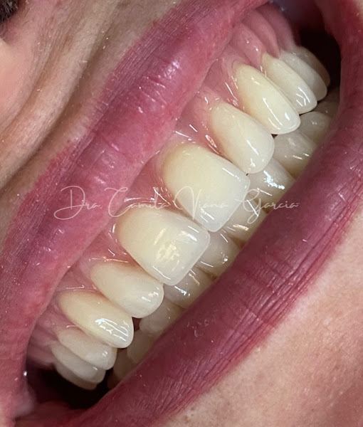 Foto 2 de VG Odontologia Especializada - Implantes Santo André