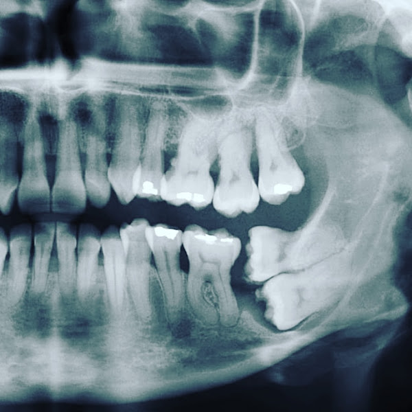 Foto 3 de VH Odontologia - Dra Vera Páfaro / Dr Hailton Borges