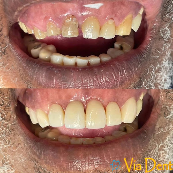 Foto 2 de Via Dent Alcântara Implante Dentário