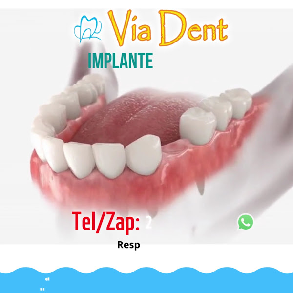 Foto 3 de Via Dent Alcântara Implante Dentário
