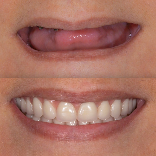 Foto 3 de Viotti Odontologia | Aparelhos Invisíveis | Implantes Dentário | Lentes Dentárias | Largo do Japonês - SP