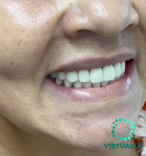 Foto 2 de Virtualle Odontologia Campo Limpo Paulista