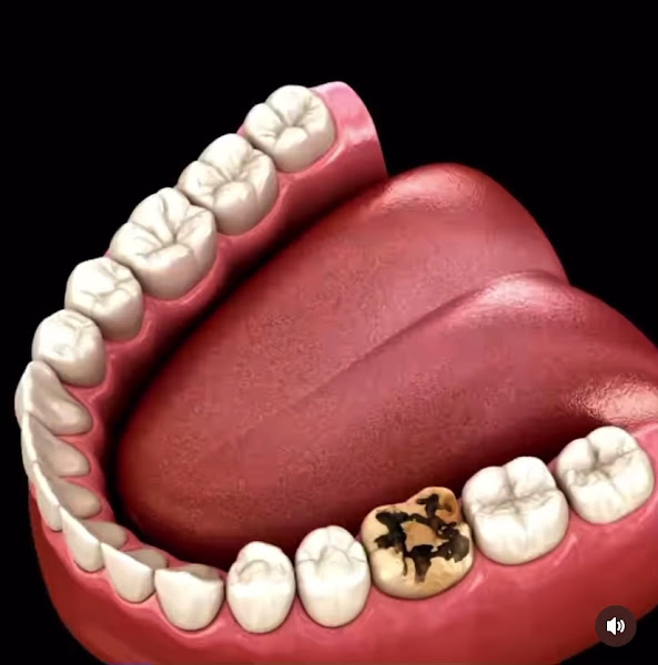 Foto 4 de Vis Avis Odontologia - Dra. Carolina Avi CRO/SP 89814