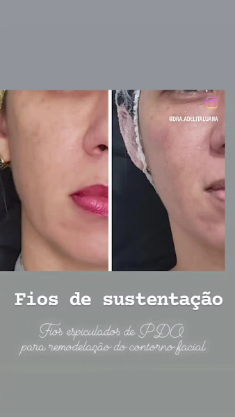 Foto 2 de Visage | DENTISTA | ESPINHEIRO