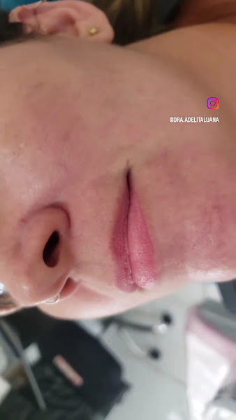 Foto 4 de Visage | DENTISTA | ESPINHEIRO