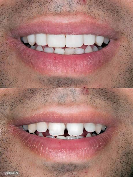 Foto 2 de VISAGE Odontologia | Implante e Prótese no Janga, Paulista PE