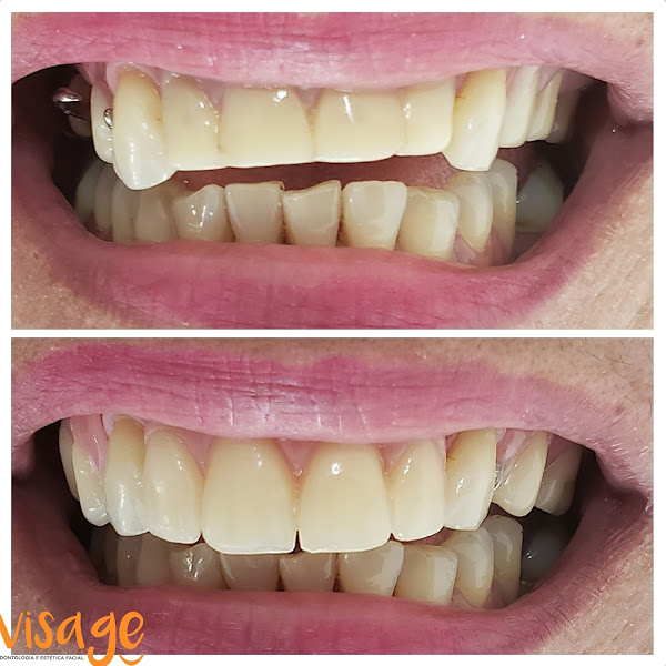 Foto 3 de VISAGE Odontologia | Implante e Prótese no Janga, Paulista PE