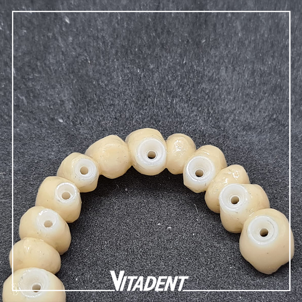 Foto 2 de Vitadent Prótese Dentária