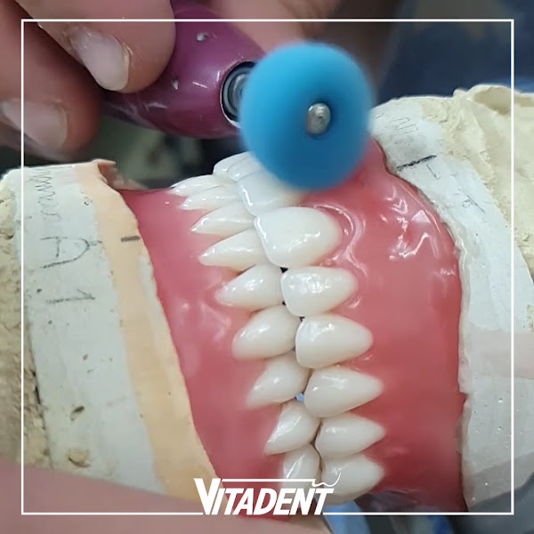 Foto 3 de Vitadent Prótese Dentária