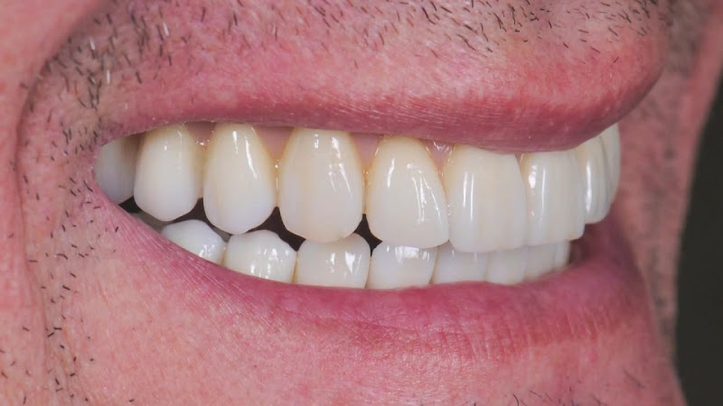 Foto 3 de Vital Dentales - Dr Andre Lasse